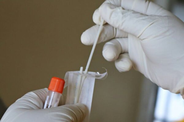 Blood sample being tested in laboratory