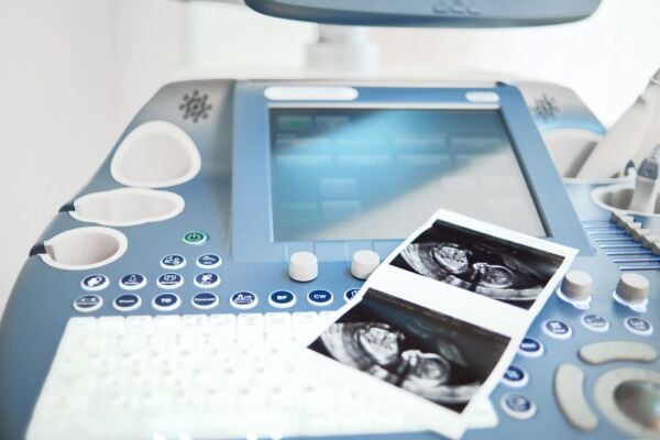 Ultrasound scanning machine for gastroparesis