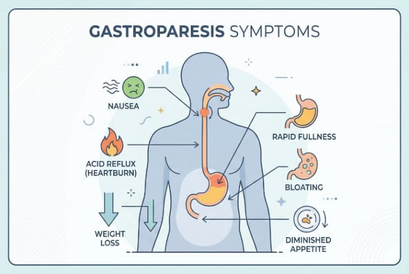 Common gastroparesis symptoms