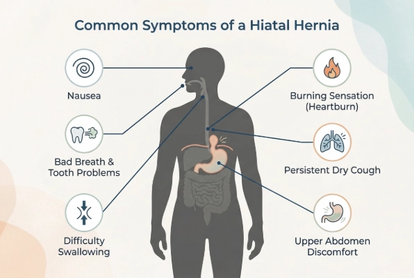 Common hiatal hernia symptoms beyond back pain