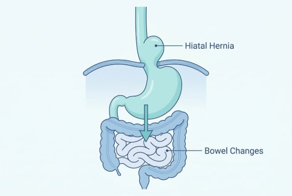 Hiatal hernia connection to bowel function