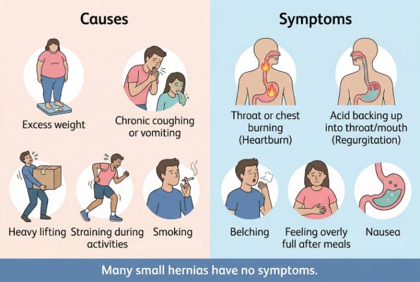 Hiatal hernia causes and symptoms