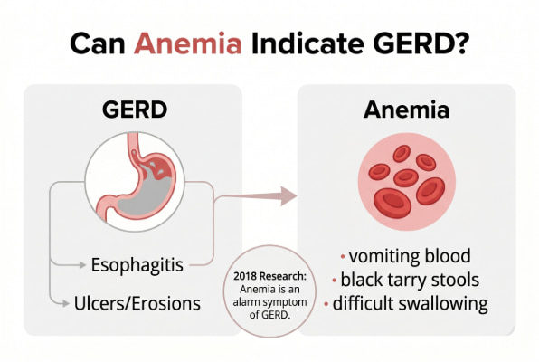How GERD complications can lead to anemia