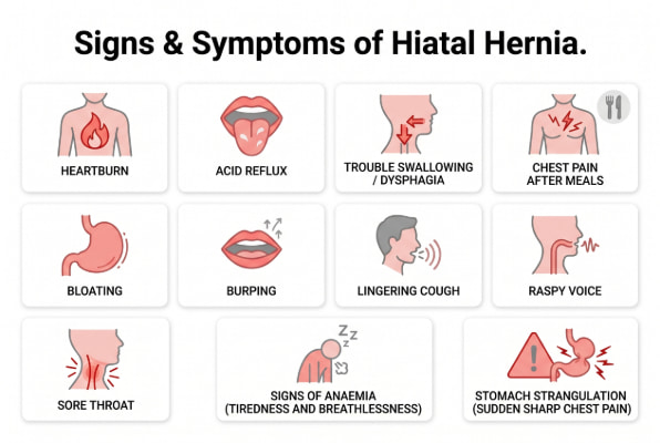 Signs and symptoms of hiatal hernia