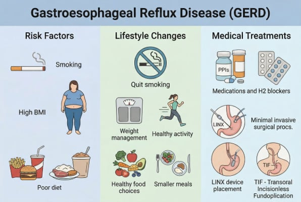 GERD risk factors and lifestyle modifications