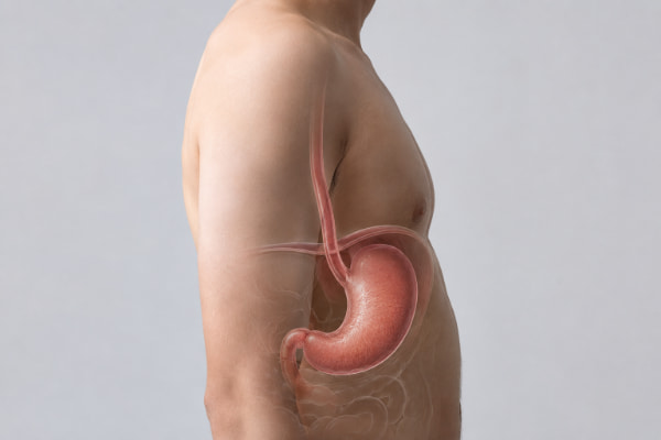 Anatomical view showing esophagus and stomach involved in acid reflux and heartburn
