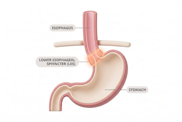 Simple diagram of esophagus and lower esophageal sphincter affected by chemo