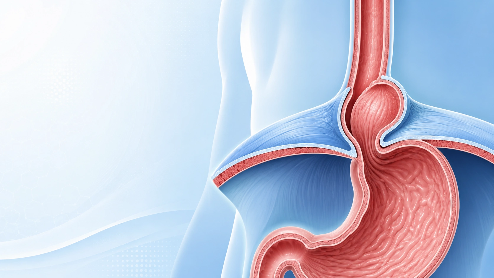 hiatal-hernia-diaphragm-illustration Cross-section illustration of a hiatal hernia where the upper stomach pushes through the diaphragm opening
